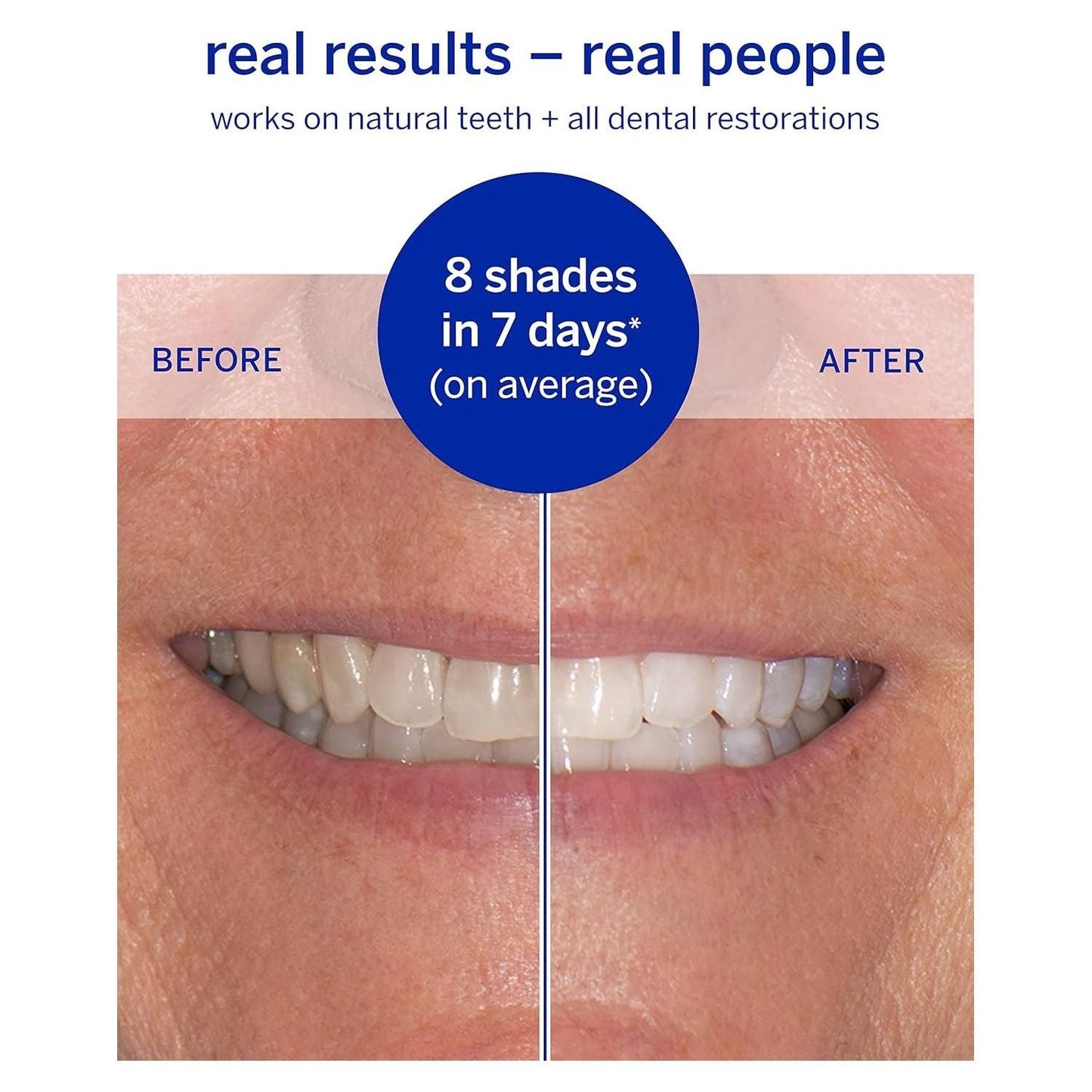 Supersmile Superstrips Teeth Whitening Dissolving Strips 14 Teeth Whitening Pasteur Pharmacy