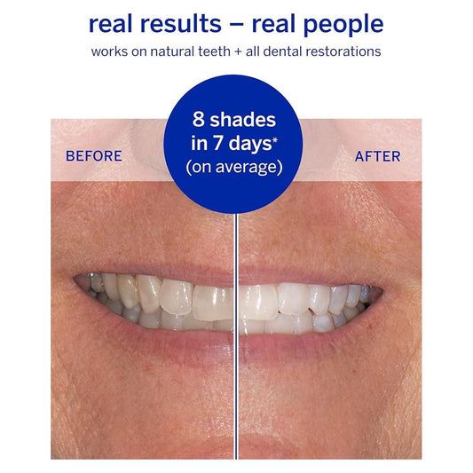 Supersmile Superstrips Teeth Whitening Dissolving Strips 14 Teeth Whitening Pasteur Pharmacy