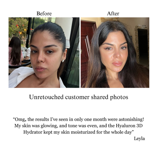 NILCEUTICA Hyaluron 3D Hydrator Multi Lamellar Emulsion The Advanced Response Face and Neck Cream-Serum Anti-aging Best Anti-aging Moisturizer for Dry skin NILCEUTICA