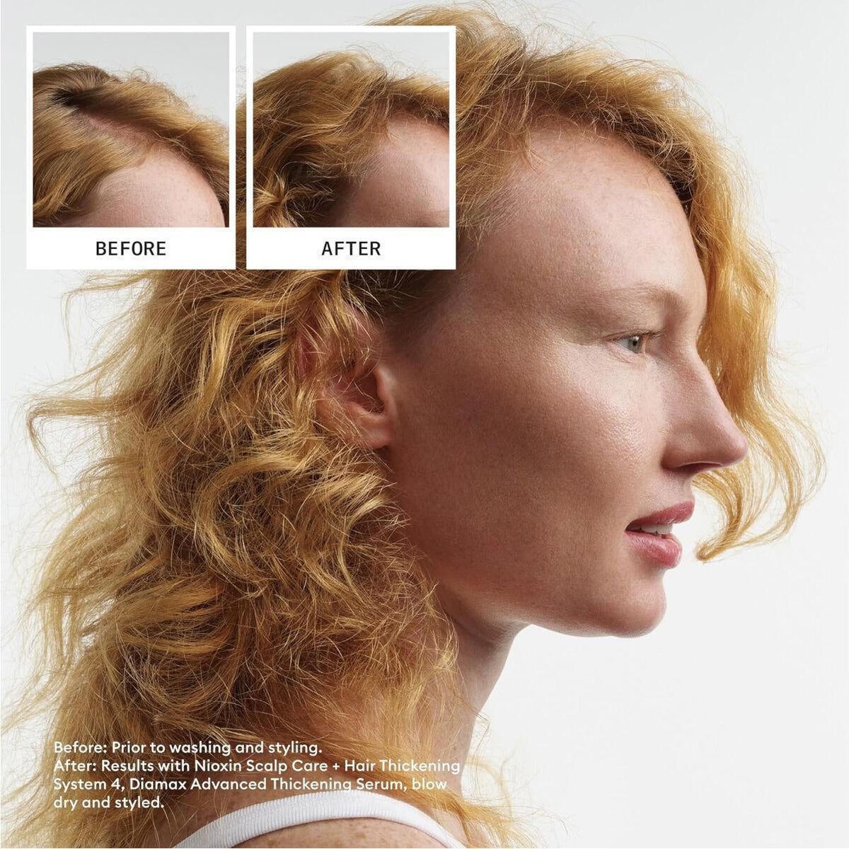 Nioxin Density System 4 Scalp Therapy Conditioner for Colored Hair with Progressed Thinning – 1000 mL / 33.8 oz