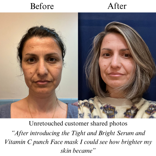 NILCEUTICA Vitamin C Punch, IMMEDIATE BRIGHTENING FACE MASK, pH balanced formula NILCEUTICA