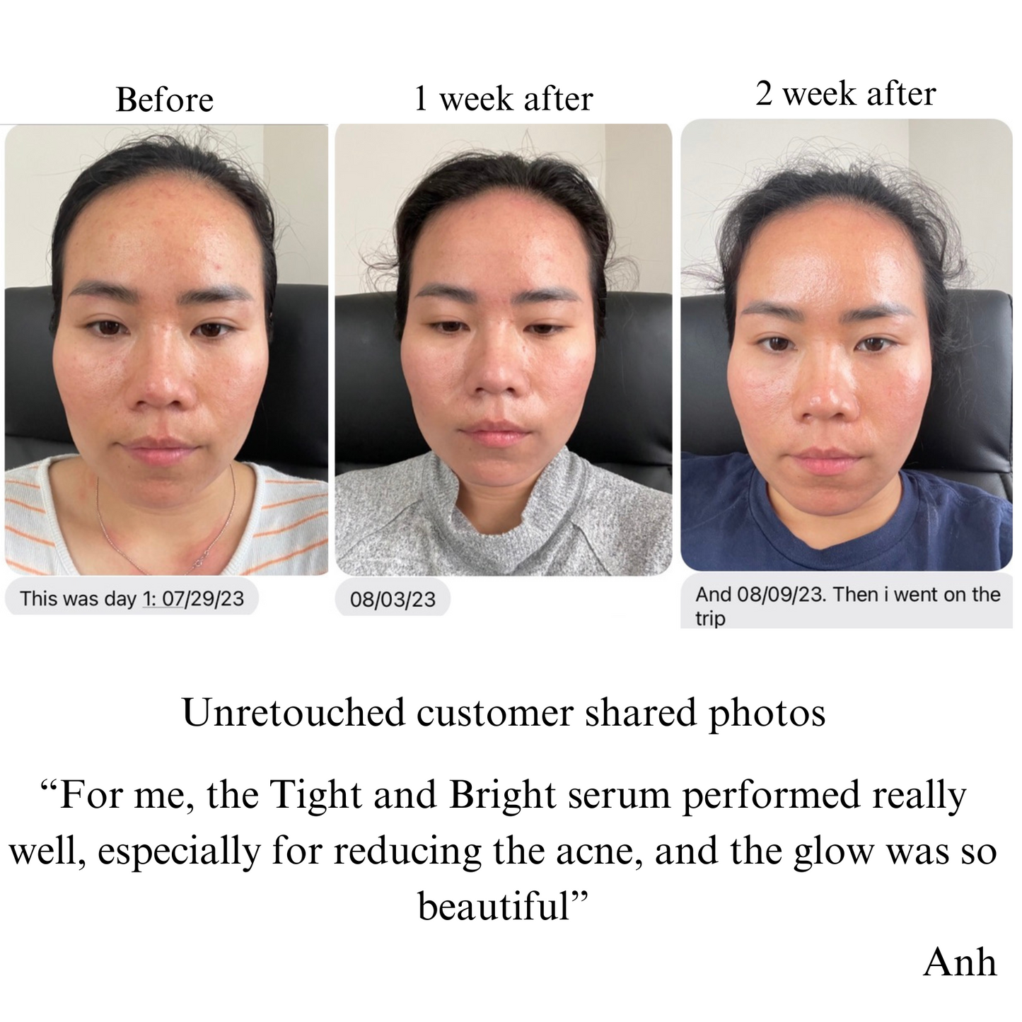 NILCEUTICA TIGHT AND BRIGHT, an Advanced Gentle Phyto-Retinol and Vitamin C Face Serum, 12 Innovative Technologies, 55% High-Performance Cosmeceuticals Anti-Aging Best Anti-aging Serum for Hyperpigmentation NILCEUTICA