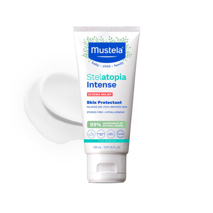 Mustela Stelatopia Intense - Crème sans corticoïdes | 30 ml