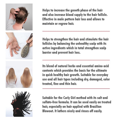 Shampooing anti-chute Swissoderm pour cheveux normaux à secs - 300 ml, renforce les follicules pileux, réduit la chute des cheveux