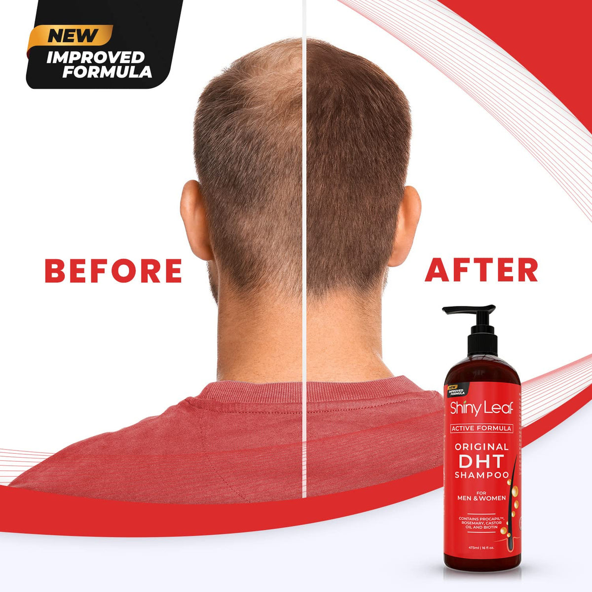 DHT Blocker Shampoo with Biotin — 16 oz