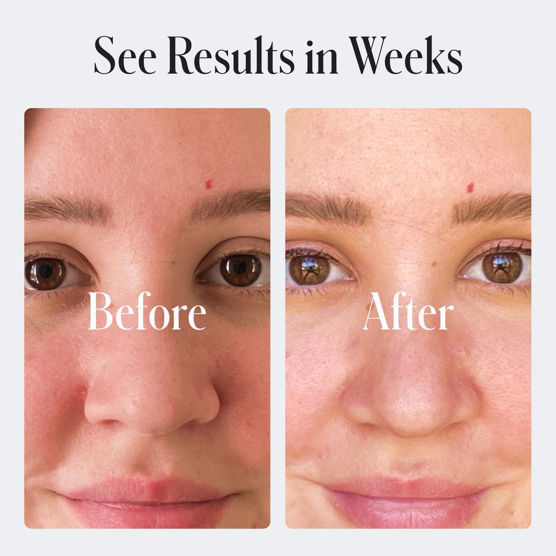 Geologie Acne Control Face Wash Geologie