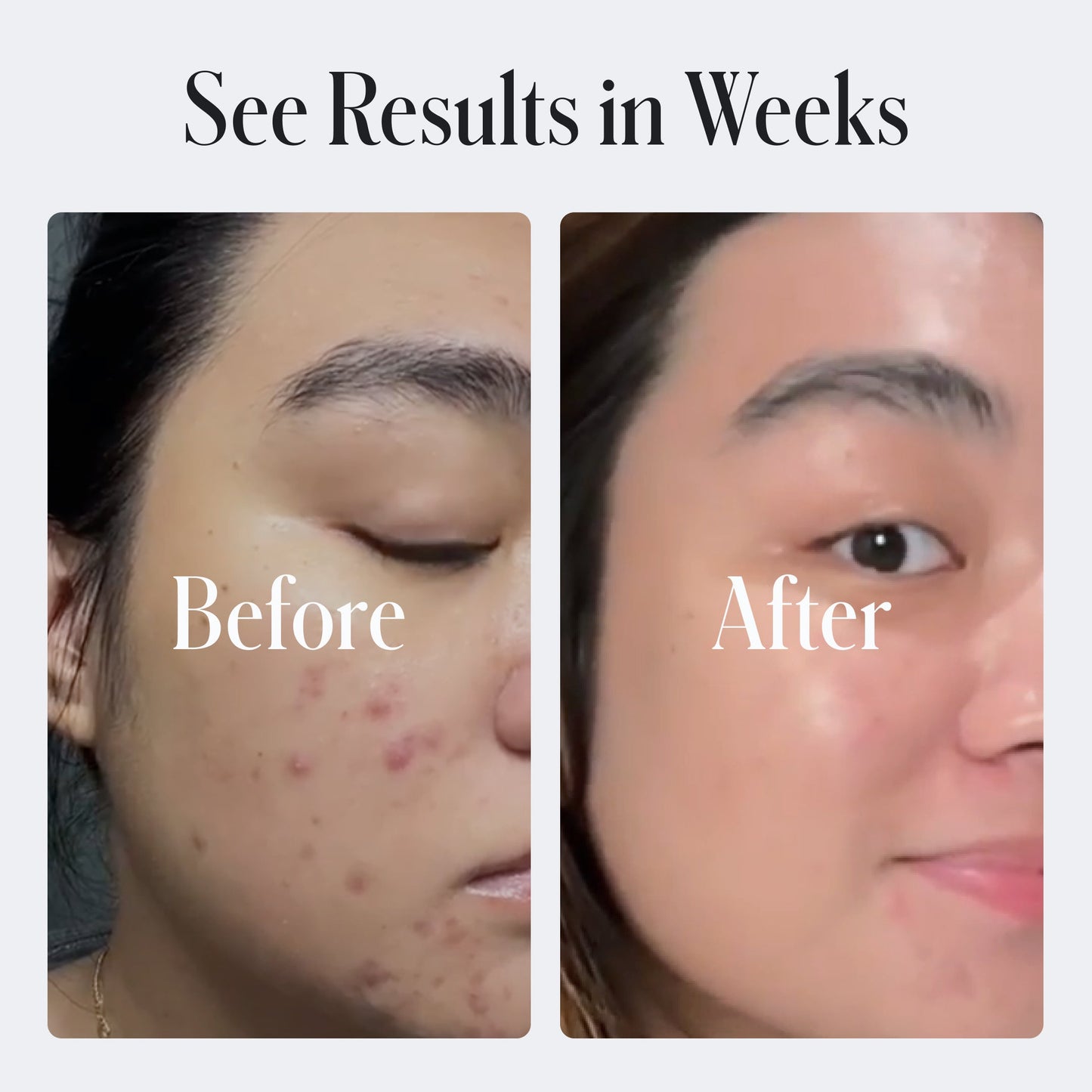 Geologie Acne Control Body Wash Geologie