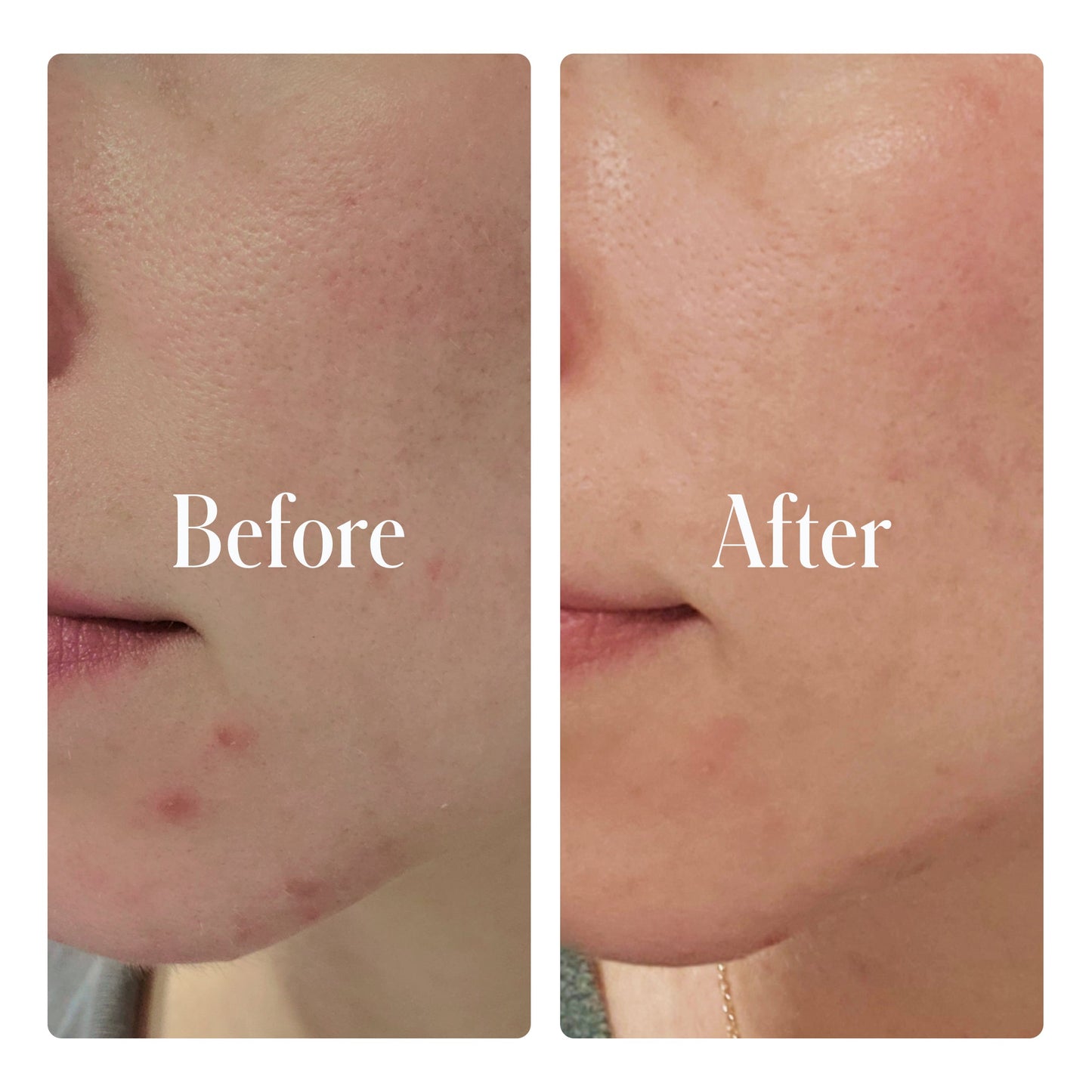 Geologie Clear System Routine Face Cream Geologie