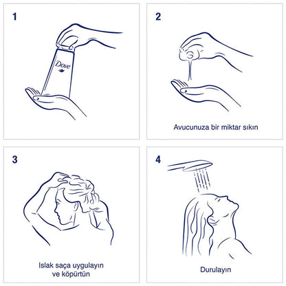 Shampoing antipelliculaire Dove Ultra Care Aloe Vera : Apaisez les cuirs chevelus secs et irrités et éliminez les pellicules grâce à l'huile d'arbre à thé naturelle - Végétalien et sans parabène