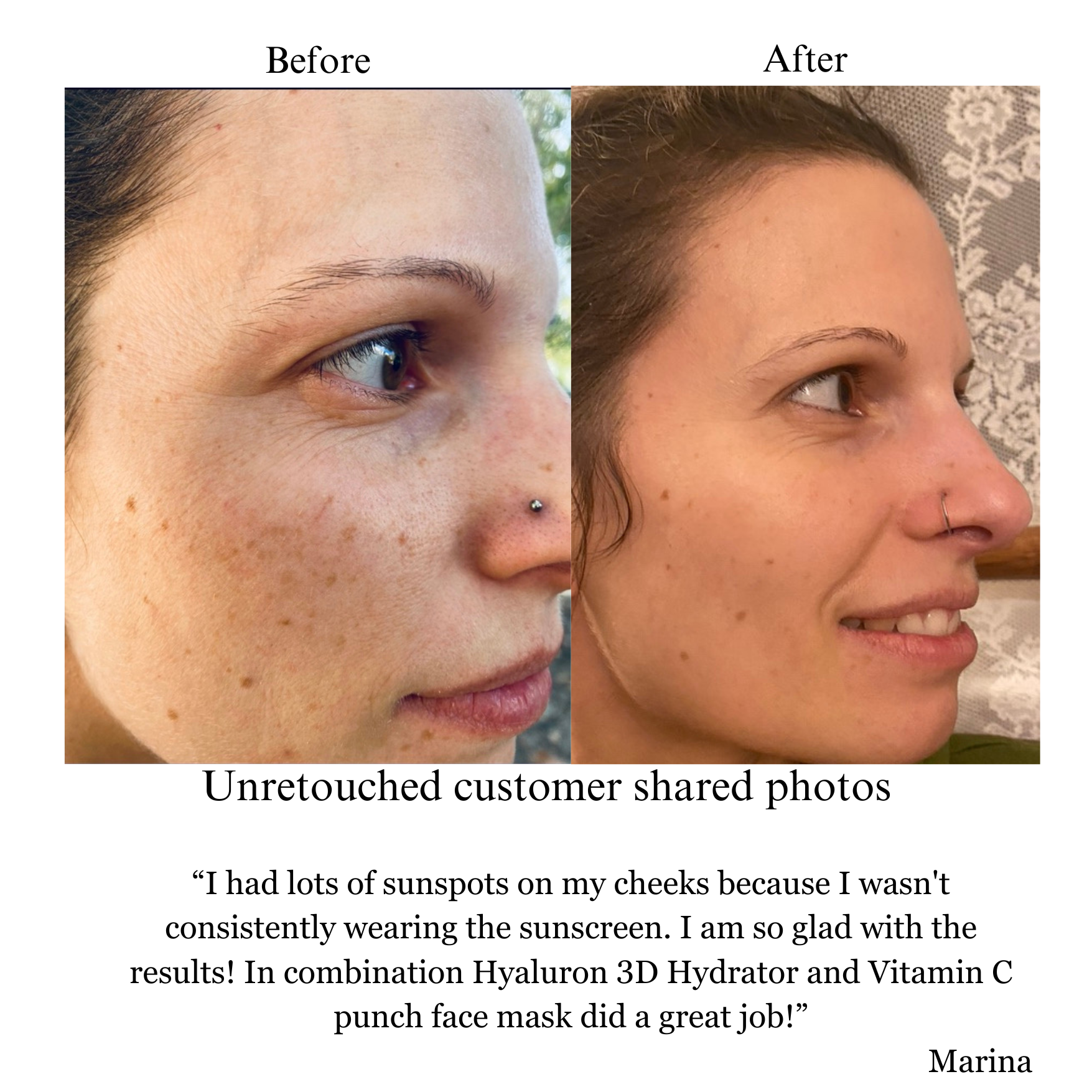 NILCEUTICA Hyaluron 3D Hydrator Multi Lamellar Emulsion The Advanced Response Face and Neck Cream-Serum Anti-aging Best Anti-aging Moisturizer for Dry skin NILCEUTICA