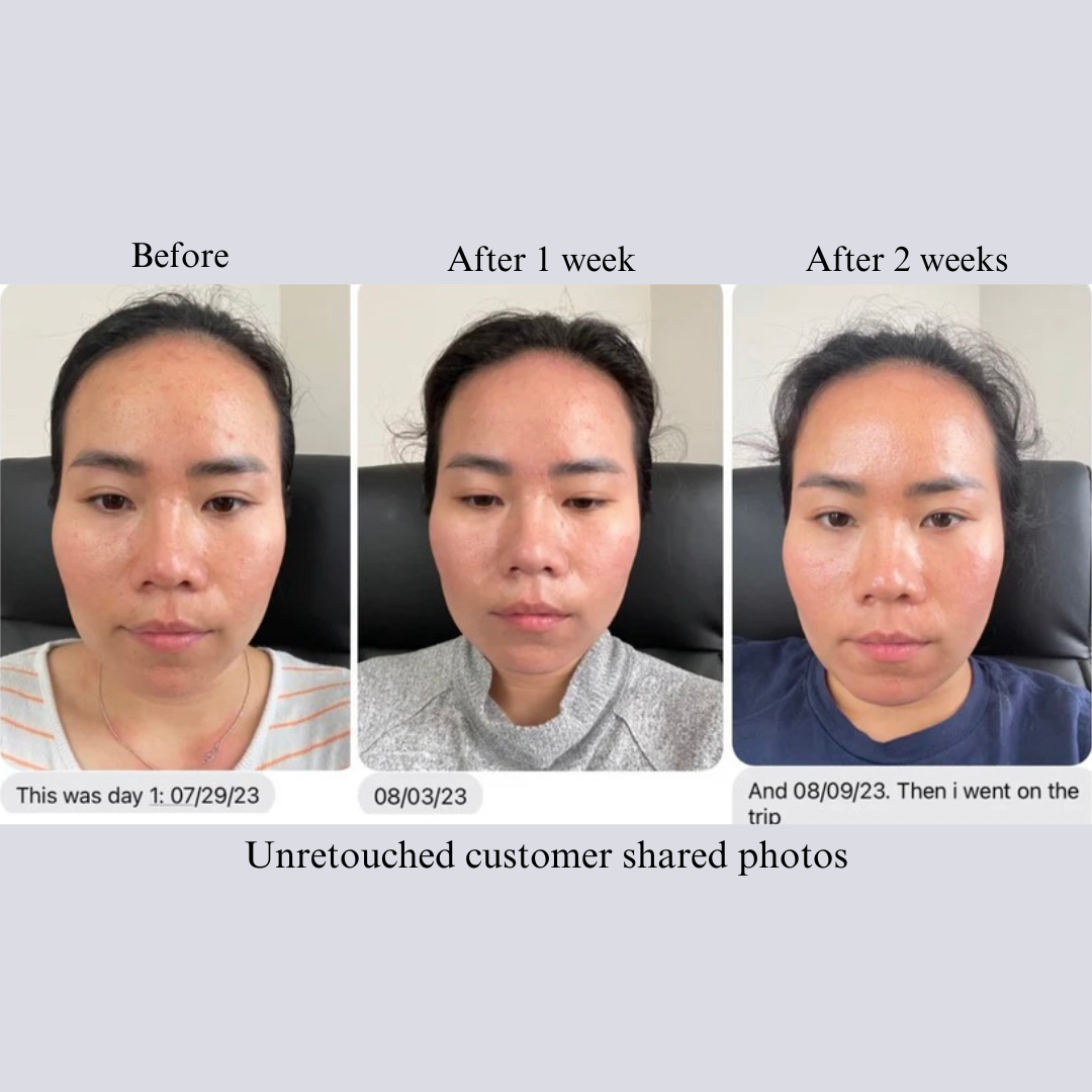 NILCEUTICA Bestsellers Discovery and Travel kit Anti-Aging NILCEUTICA
