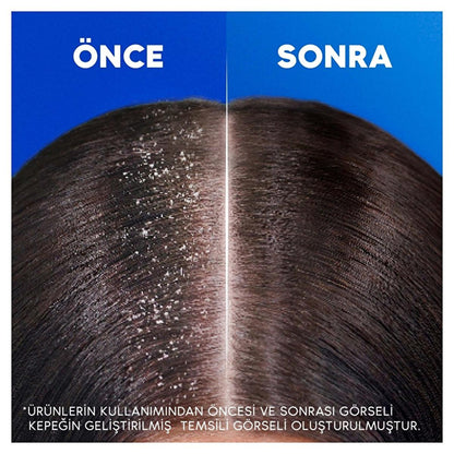 Champú anticaspa Head & Shoulders con beneficios hidratantes - Dermatológicamente probado, 11.16 fl oz