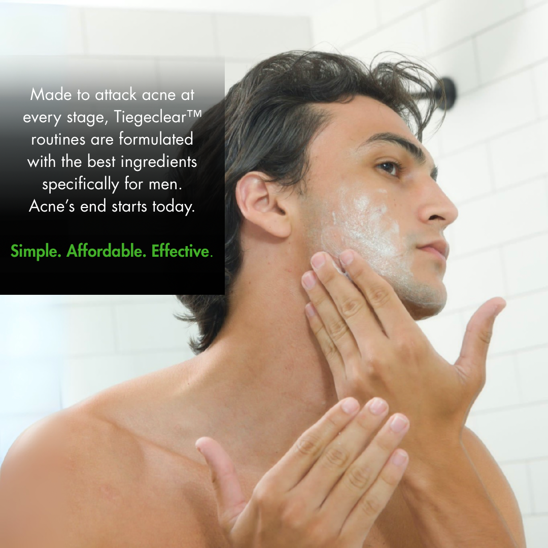 The TiegeClear® ACNE Essentials Routine for Men System Tiege Hanley