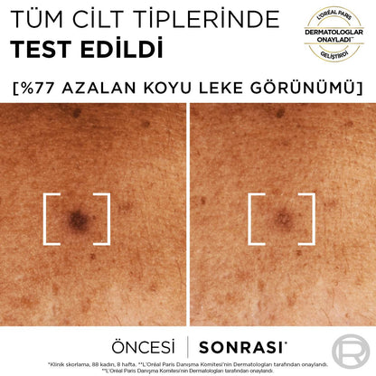 Sérum corrector de manchas oscuras con niacinamida Bright Reveal de L'Oréal Paris: atenúa marcas de acné, manchas solares y de la edad para una piel radiante